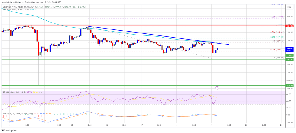 Ethereum Price Faces Crucial Test: Will $2,850 Withstand the Pressure?