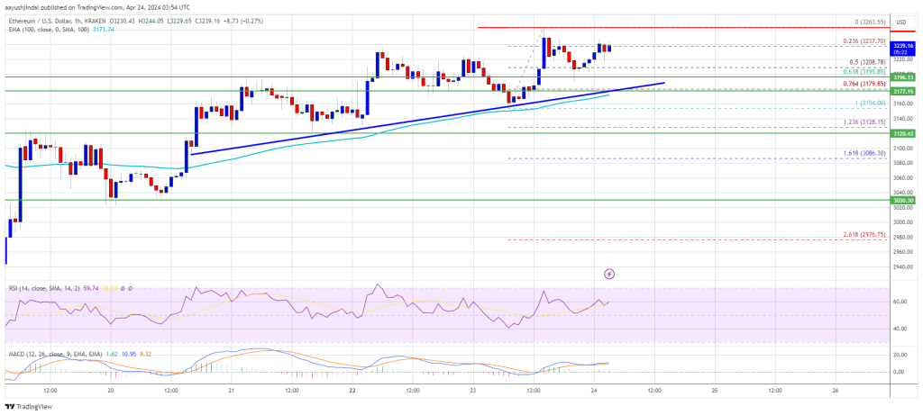 Ethereum Price Holds Support – Why ETH Could Soon Rally 5%