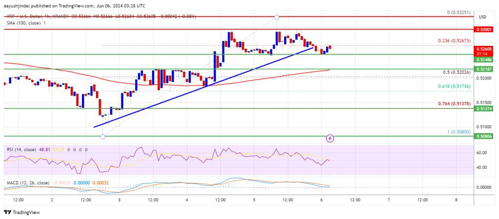 XRP Price Faces Hurdles: Will It Overcome the Obstacles?